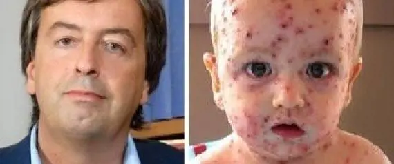 Il professore: "Non vaccinate i vostri figli? Ecco cosa gli succede"
