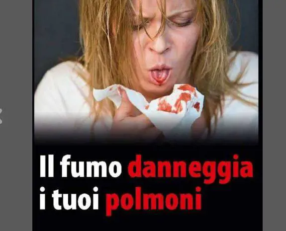 Immagine gallery