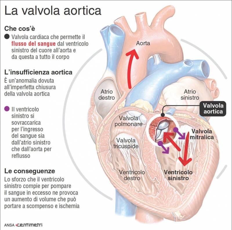 Valvola aortica