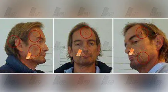Omicidio Ferrara, i segni sul volto di Cagnoni