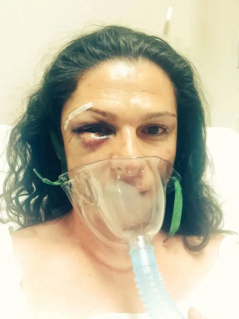 Senatrice cade dalla moto. E in quattro la pestano a sangue