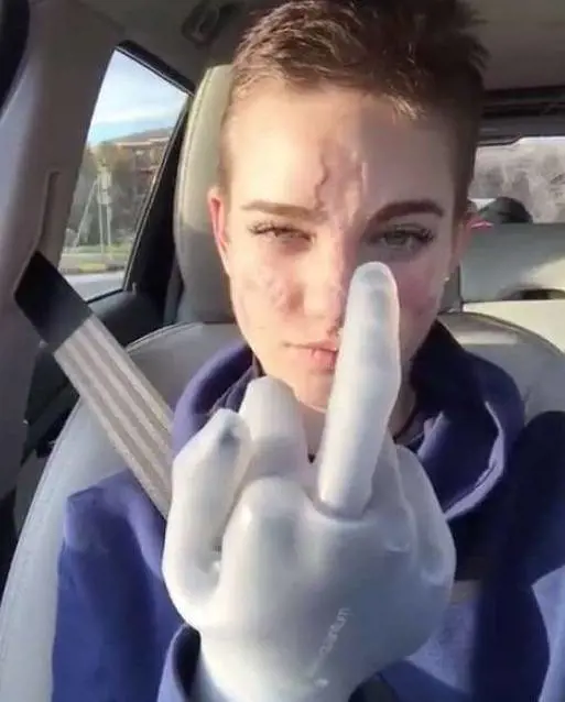 Bebe Vio fa il dito medio ai suoi haters