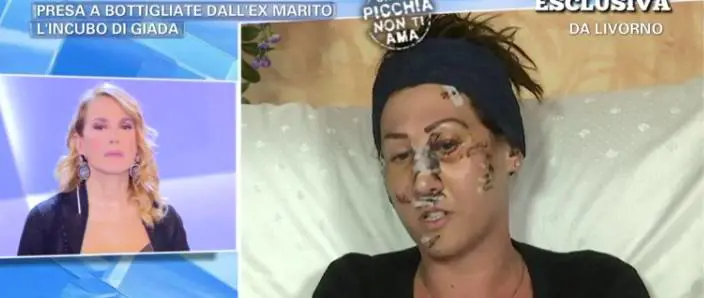 Il racconto straziante di Giada presa a bottigliate da ex marito