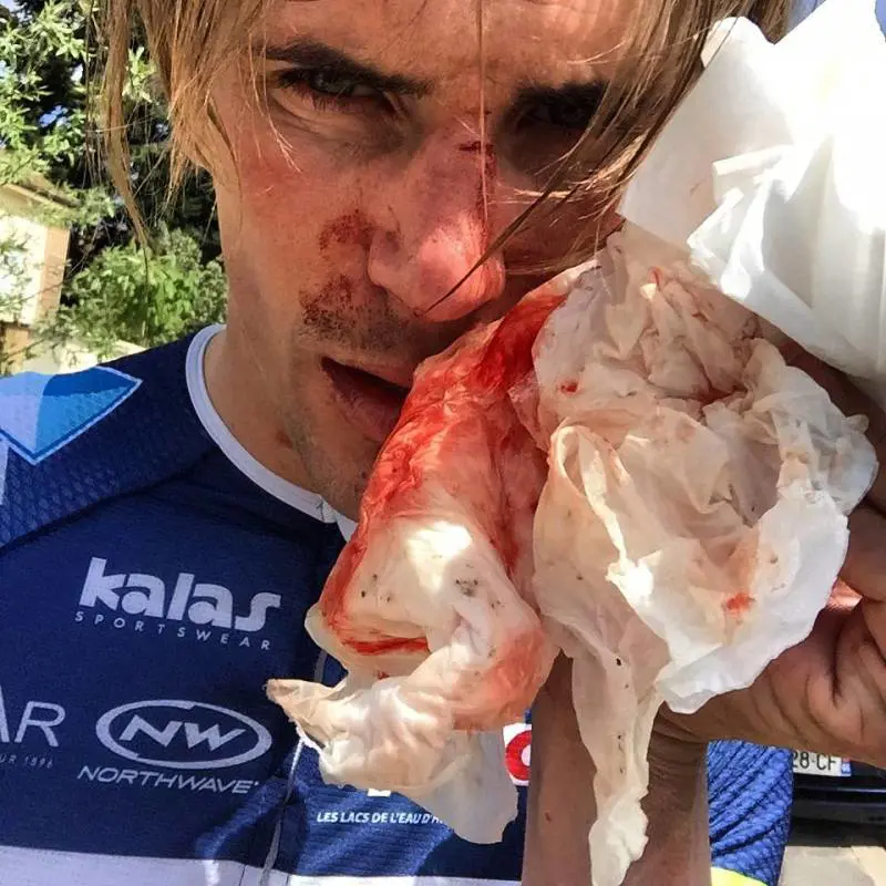 Picchiato e minacciato Offredo: "Aggredito con mazza e coltello"
