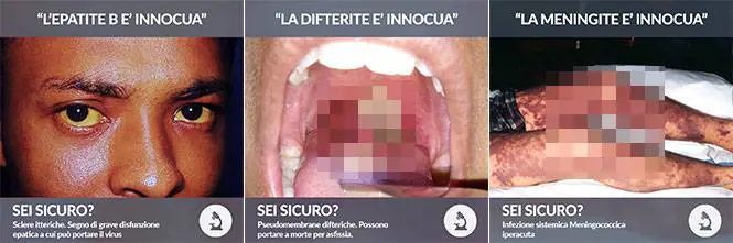 Vaccini, foto choc sulle malattie "Così muore chi non si vaccina"