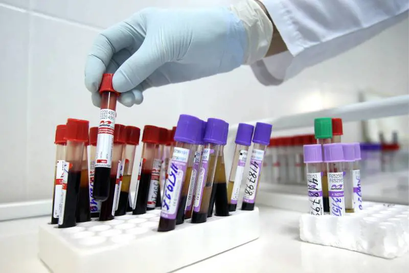 Belluno, muore per scambio di provette con omonimo: medici a processo