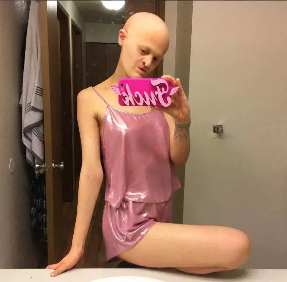 Melanie Gaydos, la modella senza denti e calva voluta dai fotografi