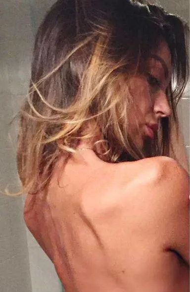 Immagine gallery