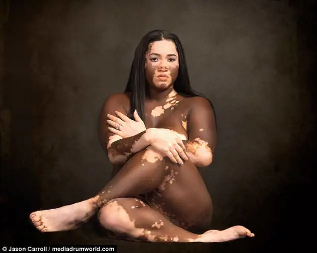 Iomikoe, la modella nera che vuole diventare bianca