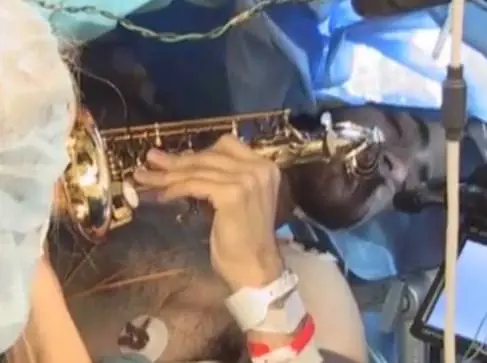 Suona il sassofono mentre lo operano per un tumore al cervello