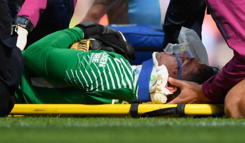 Fallo killer di Mané su Ederson: ecco come è ridotta la faccia del portiere