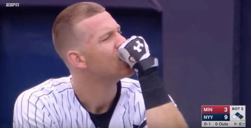 Baseball, bimba colpita al volto dalla pallina: lacrime in campo 