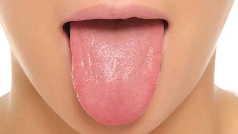 Il colore della lingua ci racconta il nostro stato di salute