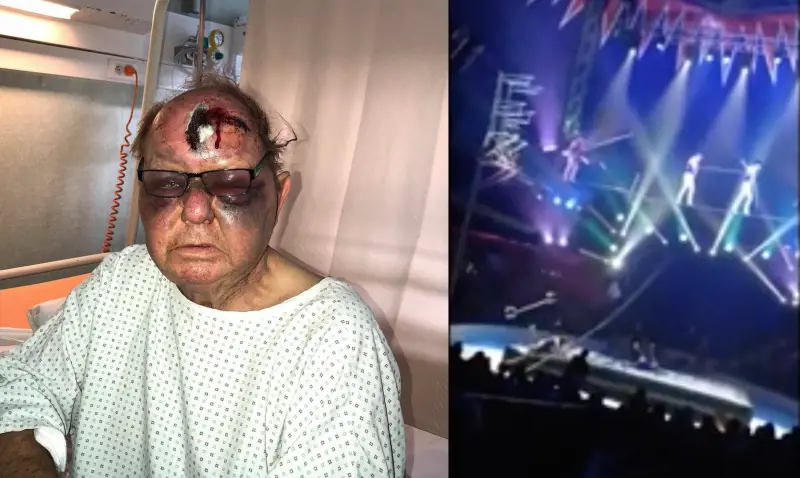 Dramma al circo: funamboli cadono ​e l'asta di ferro colpisce spettatore