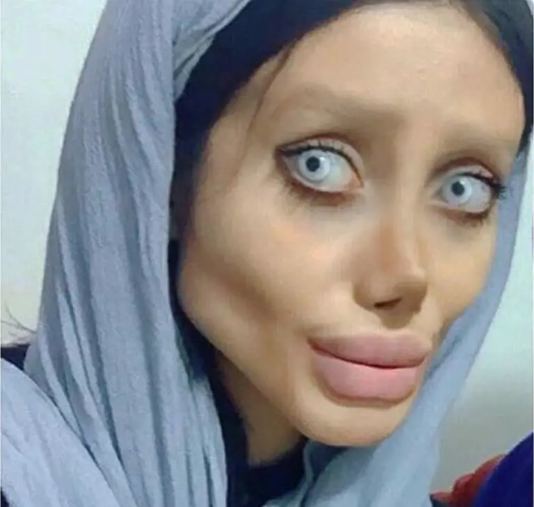 Tre anni, cinquanta interventi per somigliare a Angelina Jolie