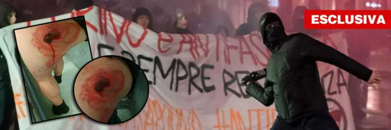 Torino, bombe antagoniste con i chiodi: agente trafitto alla gamba