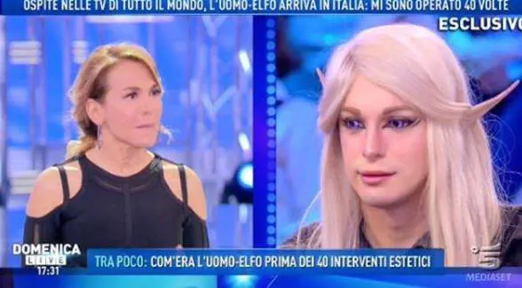Domenica Live, l'uomo-elfo: "I bulli mi prendevano in giro così mi sono trasformato"