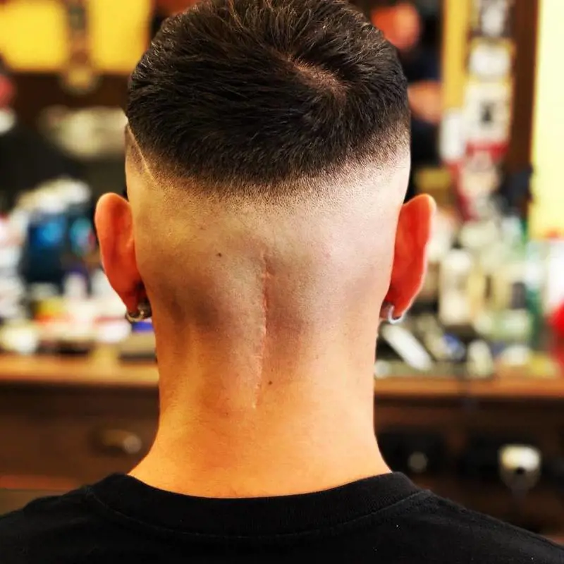 Castan da brividi: "La cicatrice alla testa è simbolo della mia rinascita"