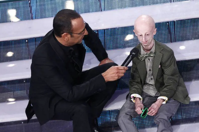 Un'altra vittoria per Sammy Basso: il 22enne affetto dalla sindrome dell'invecchiamento precoce si è laureato