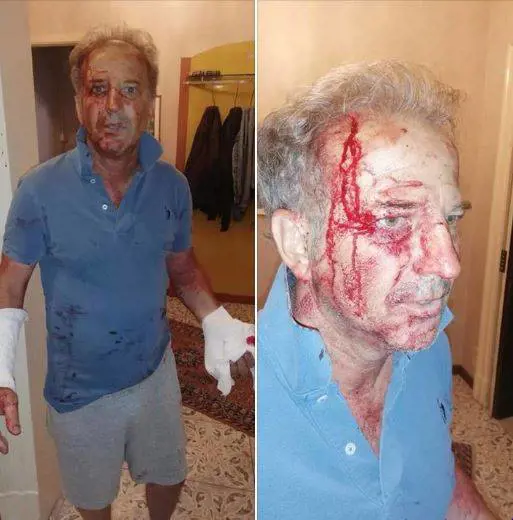 Migranti massacrano poliziotto. Pugnalato a sangue in casa: le foto choc
