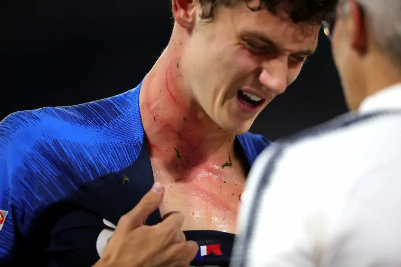 Falli, tattica e grandi occasioni. Ma tra Germania e Francia finisce 0-0