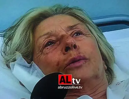 Lanciano, la donna mutilata: "Io perdono, lo Stato sia severo"
