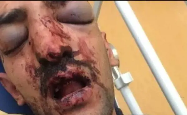 La foto di Nabil in ospedale, diffusa dai familiari