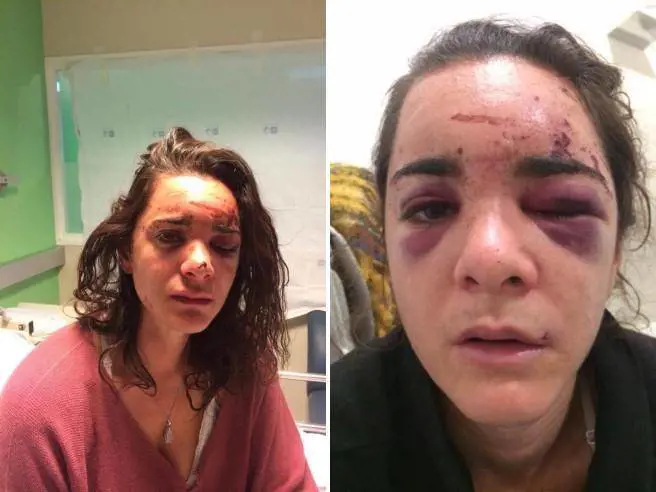 Andrea Sicignano: "Sono stata violentata. Adesso racconto tutto"