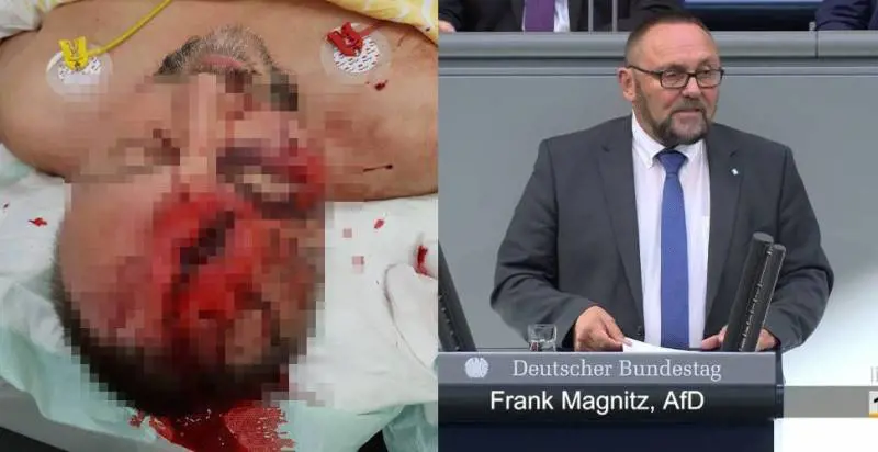 Germania, aggredito a Brema deputato dell'Afd