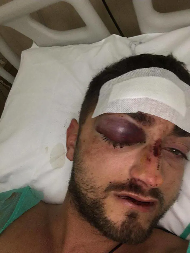 Poliziotto pestato dal marocchino. La foto choc con la testa spaccata