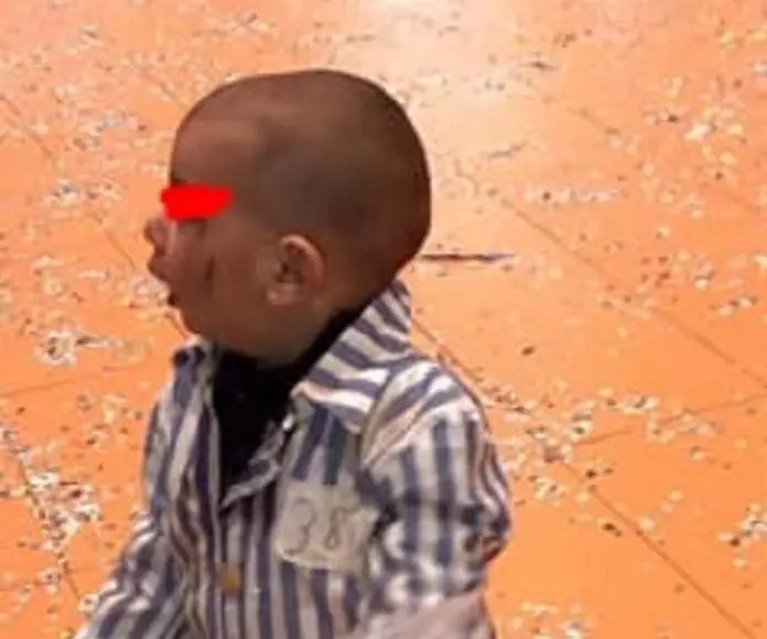 Per Carnevale fanno indossare al figlio un pigiama a righe. È polemica sui social
