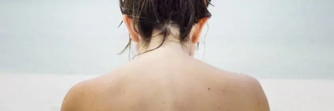 Allergia al sole, quali sono i sintomi e come si cura