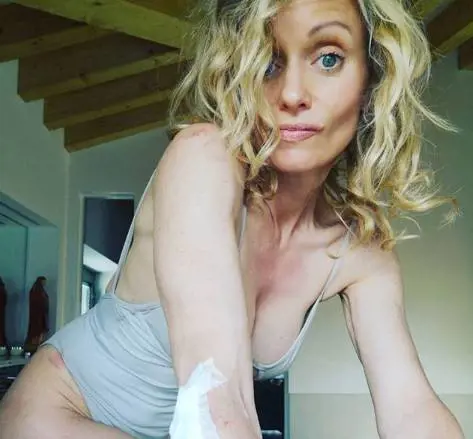 Justine Mattera piena di lividi sui social: "Ma si può a 48 anni!?"
