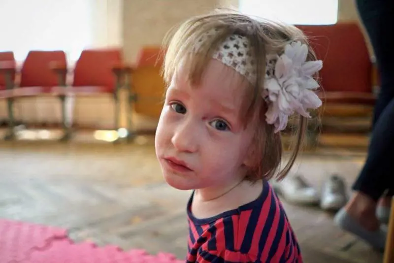 La figlia nasce con disabilità. I genitori: "Staccatele la spina"