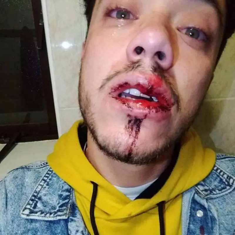 Dublino, giovane preso a sprangate per aver salutato il fidanzato