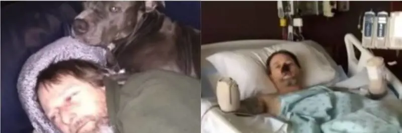 La bava del suo cane lo infetta: gli amputano braccia e gambe