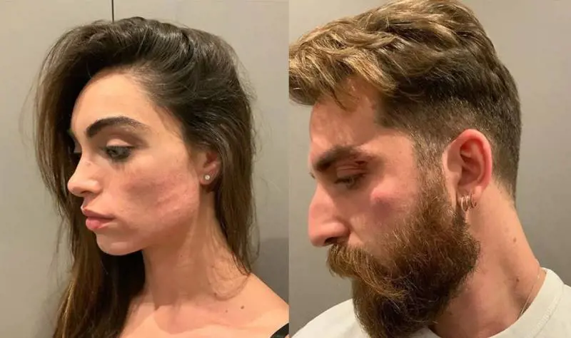 Lorella Boccia e Niccolò Presta derubati e minacciati con un coltello: "Uomini di m..."