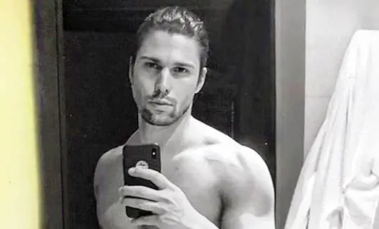 Luca Onestini e la vitiligine: "Mi dicevano che facevo schifo"