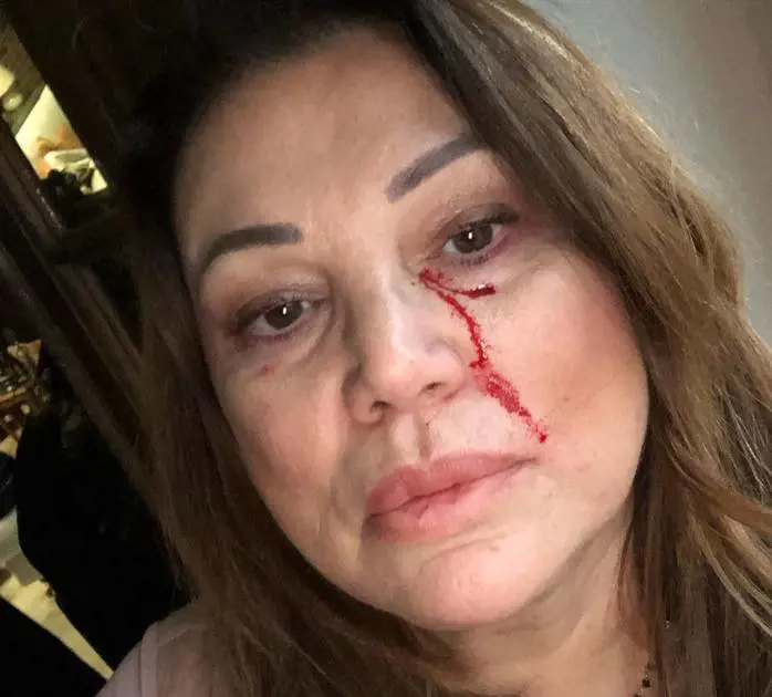 Serena Grandi sui social col sangue sul viso, fan preoccupati ma l'attrice rassicura