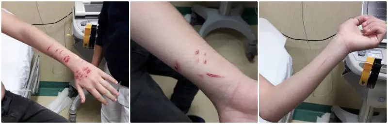  Studente di 14 anni aggredito e ferito a colpi di lamette da due persone