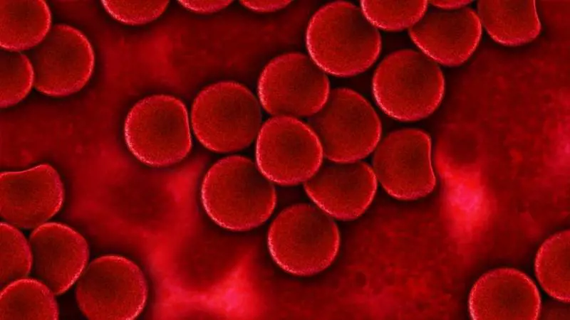 Emofilia, in Italia arriva la terapia genica