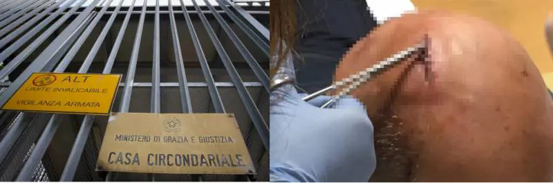In carcere gli spaccano la testa. Agente ferito da un detenuto