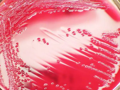 Shigella, il batterio responsabile della dissenteria