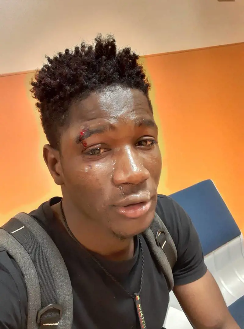 "Negro di m... vai via": baby gang picchia senegalese in pieno centro
