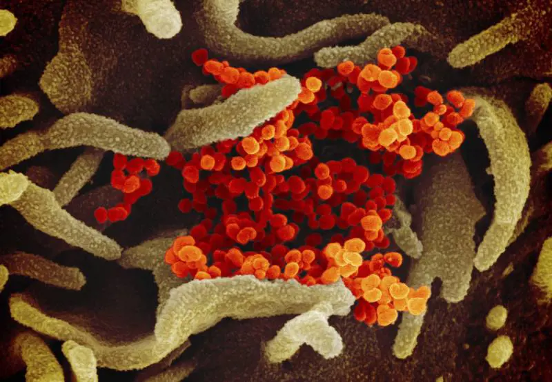 Coronavirus, il virologo Caruso: "I divieti non bastano. Vanno estesi anche al Sud"
