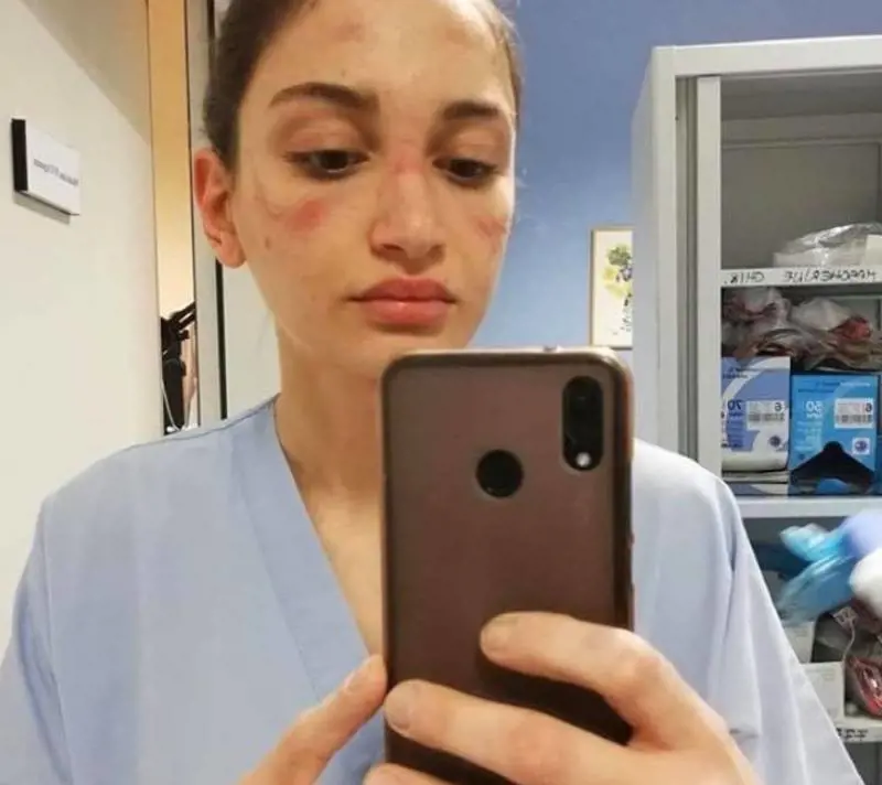 L'infermiera con il volto segnato dalla mascherina: "State in casa"
