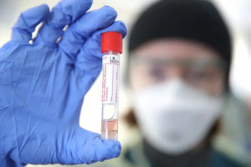 Ecco i test di massa sugli anticorpi: si scoprirà chi ha avuto il virus