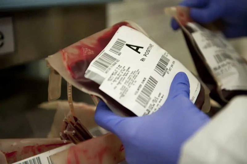 Anemia mediterranea, quali sono i sintomi?