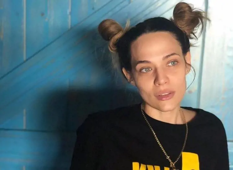 Laura Chiatti preoccupa i fan: "La magrezza sta divorando la tua bellezza"
