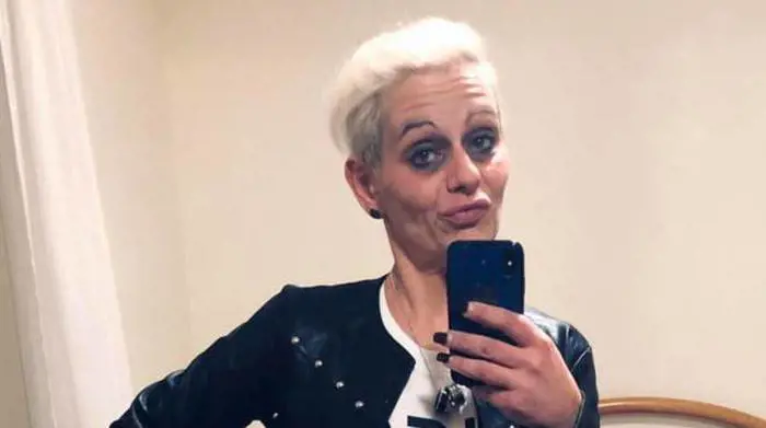 Stalkerizzato e sfregiato con l'acido ma per i giudici non c'è premeditazione